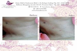 Skinbooster