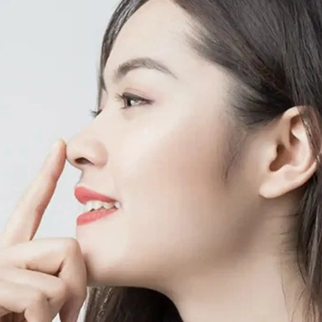 Cara Memancungkan Hidung Tanpa Operasi